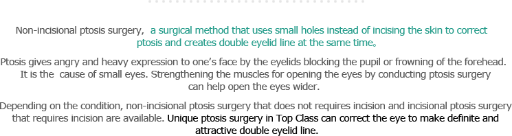 Non-incisional ptosis surgery，a surgical method that uses small holes instead d of incising the skin to correct ptosis and creates double eyelid line at the same time。Ptosis gives angry and heavy expression to one’s face by the eyelids blocking the pupil or frowning of the forehead. It is the  cause of small eyes. Strengthening the muscles for opening the eyes by conducting ptosis surgery can help open the eyes wider.  
Depending on the condition, non-incisional ptosis surgery that does not requires incision and incisional ptosis surgery that requires incision are available. Unique ptosis surgery in Top Class can correct the eye to make definite and attractive double eyelid line.