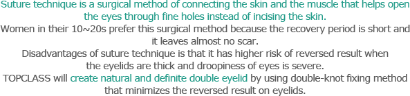Suture technique is a surgical method of connecting the skin and the muscle that helps open the eyes through fine holes instead of incising the skin. Women in their 10~20s prefer this surgical method because the recovery period is short and it leaves almost no scar. Disadvantages of suture technique is that it has higher risk of reversed result when the eyelids are thick and droopiness of eyes is severe. TOPCLASS will create natural and definite double eyelid by using double-knot fixing method that minimizes the reversed result on eyelids.