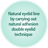 Natural eyelid line by carrying out natural adhesion double eyelid technique