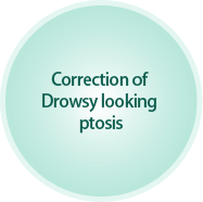 Correction of Drowsy looking ptosis