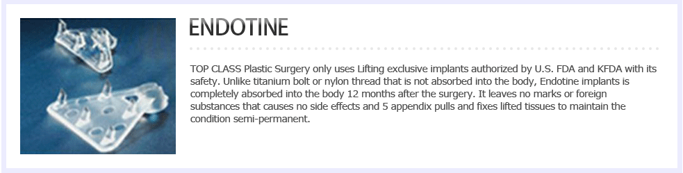ENDOTINE Top Class Plastic Surgery only uses Lifting exclusive implants authorized by U.S. FDA and KFDA with its safety. Unlike titanium bolt or nylon thread that is not absorbed into the body, Endotine implants is completely absorbed into the body 12 months after the surgery. It leaves no marks or foreign substances that causes no side effects and 5 appendix pulls and fixes lifted tissues to maintain the condition semi-permanent. 