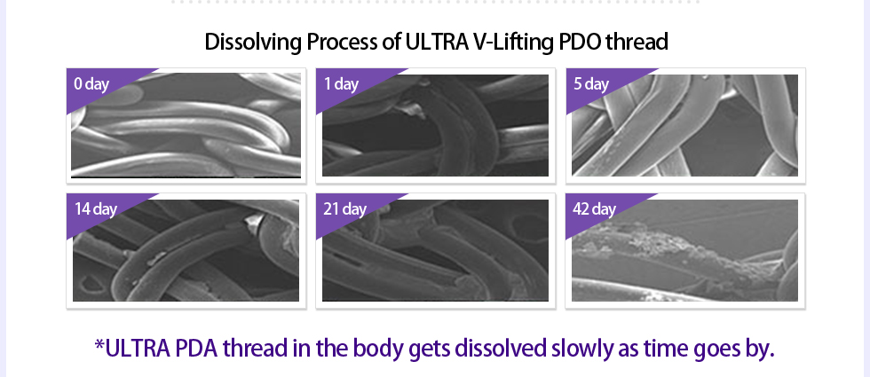Dissolving Process of ULTRA V-Lifting PDO thread, *ULTRA PDA thread in the body gets dissolved slowly as time goes by.